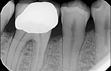 parodontologia torino protesi